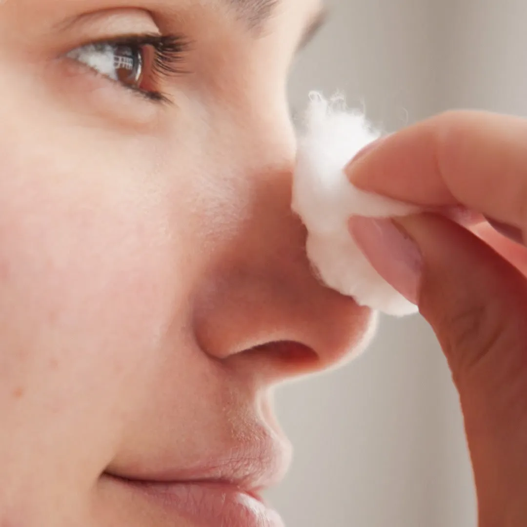 Acne Toner - Acne Treatment
